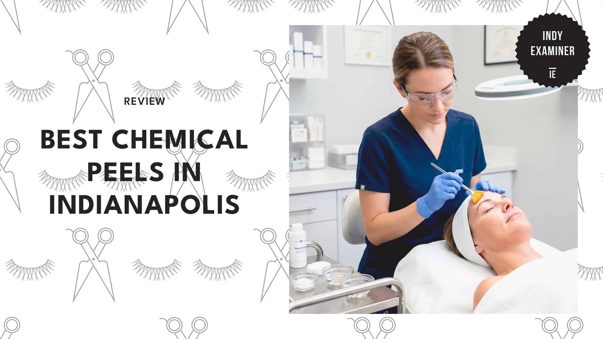 chemical-peels-in-indianapolis