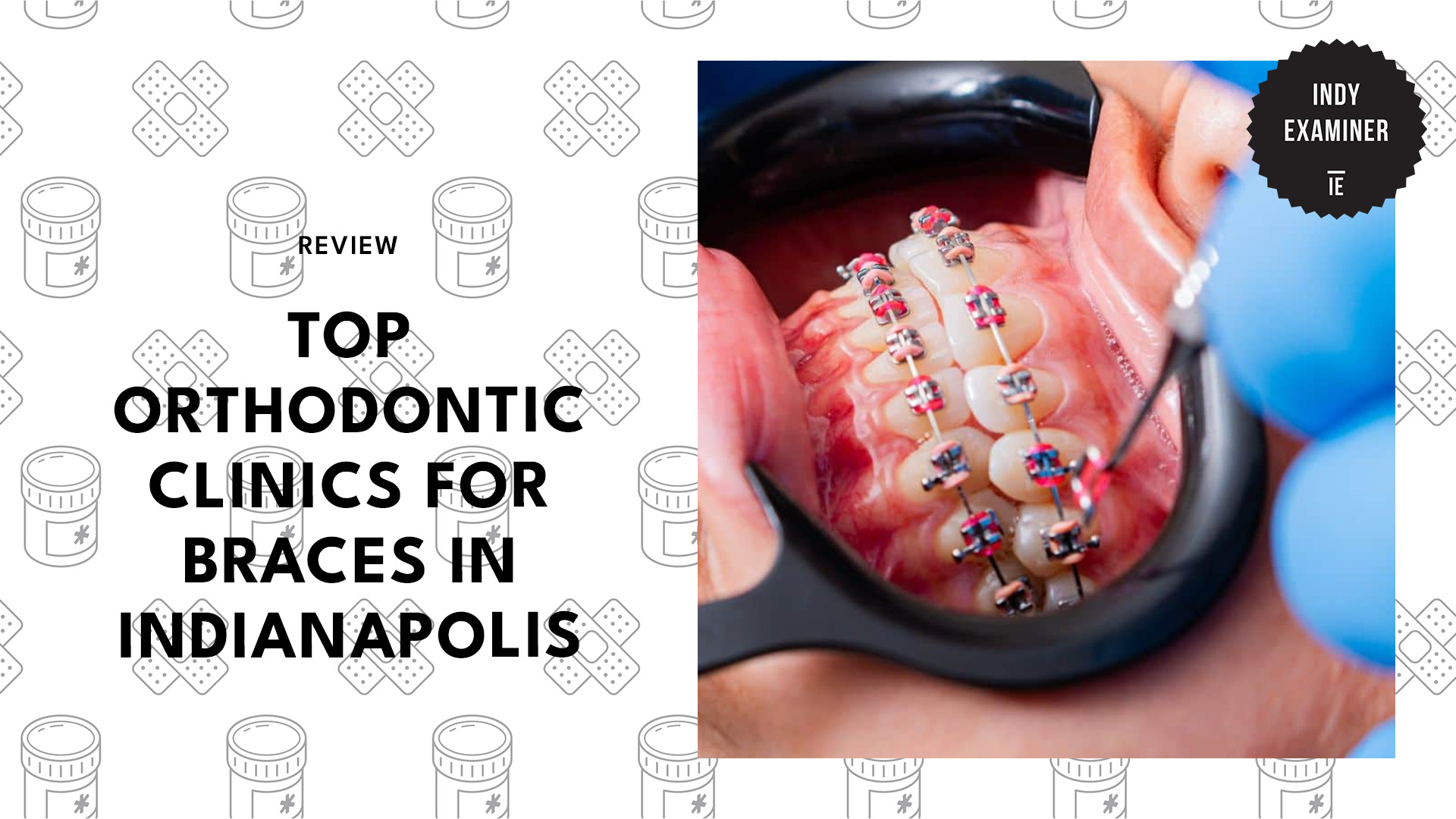 top-orthodontic-clinics-indianapolis-banner
