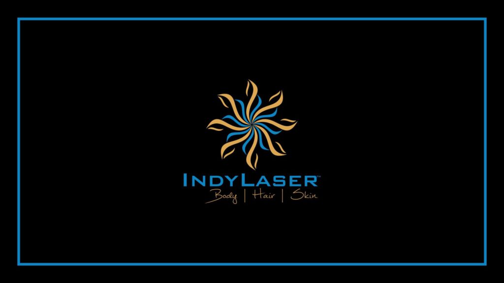 indy-laser