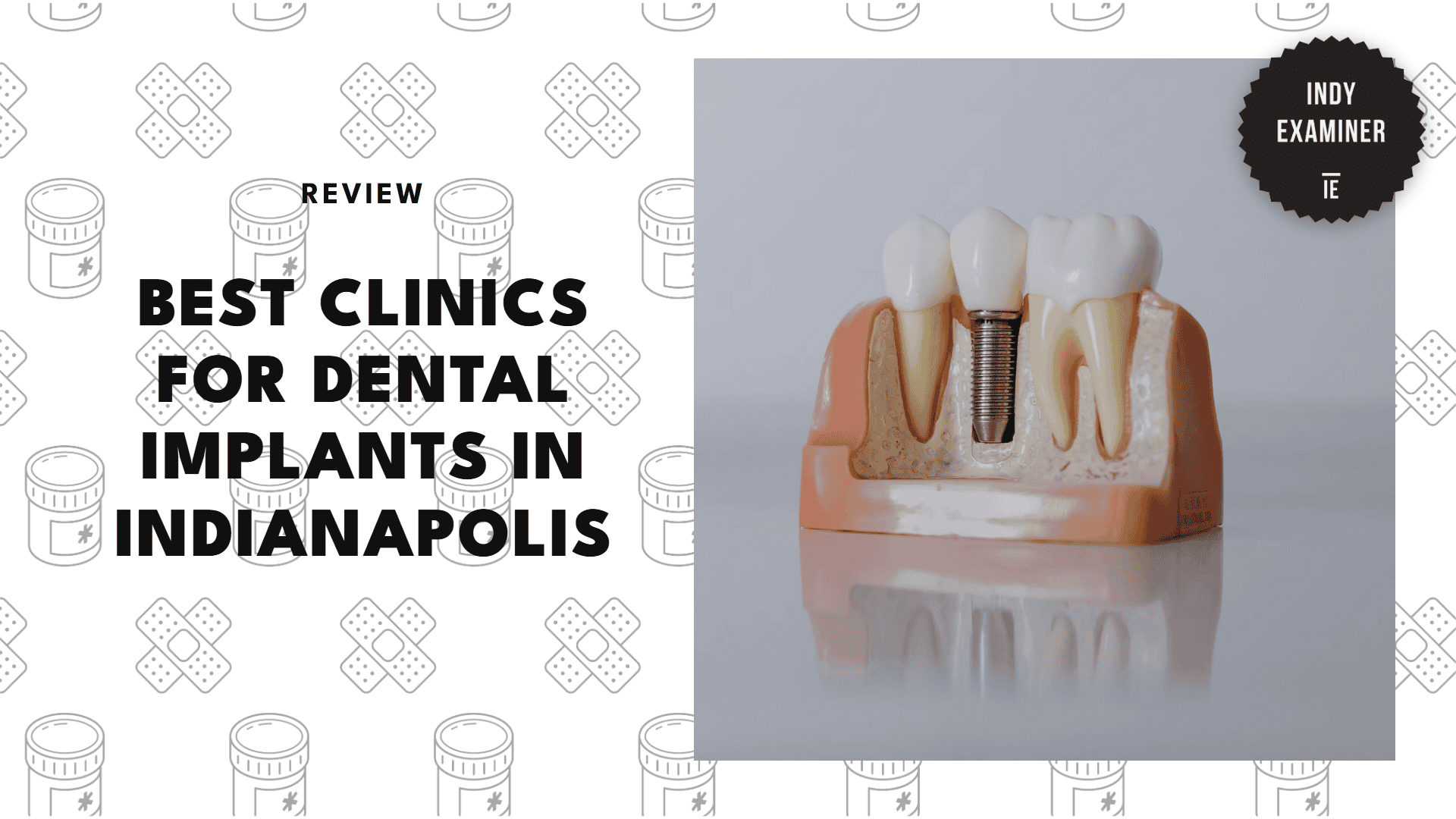 best-dental-implant-indianapolis